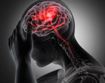 Best Neurologist in India